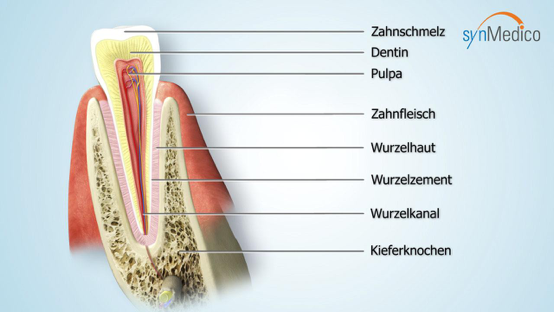 Abbildung eines Zahns von Innen 