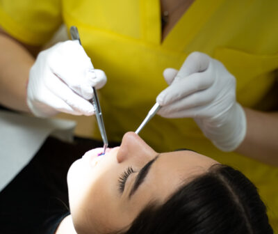 Zahnärztliche Kontrolle in der Zahnarztpraxis MKG Plus in Münster: Eine Patientin liegt entspannt im Behandlungsstuhl, während eine Fachkraft mit weißen Einmalhandschuhen und zwei Instrumenten, Mundspiegel und Sonde, ihre Frontzähne untersucht. Ruhige, konzentrierte Behandlungssituation.